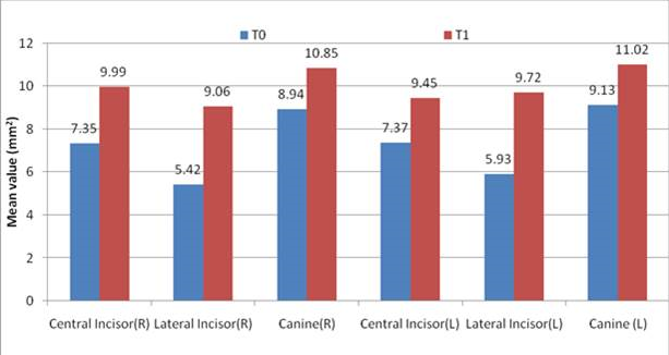 Change in alveolar bone mean area at buccal side