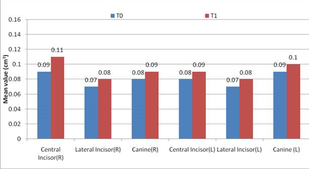 Change in alveolar bone volume at buccal side