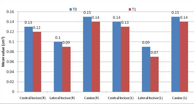 Change in alveolar bone volume at palatal side