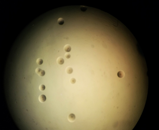 PPLO agar showing fried egg colonies