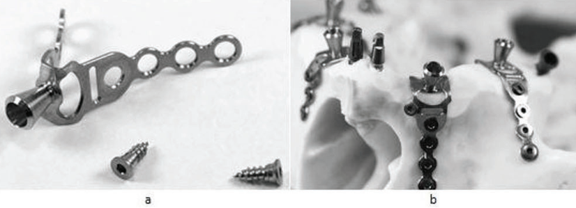 Plate Form Implants (a,b)
