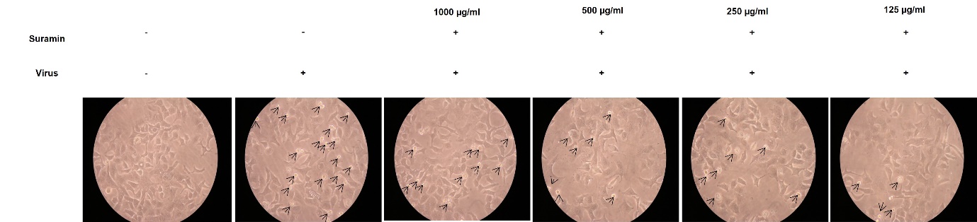 Cytopathic effect. PR8 induced cytopathic effect in A549 cells at 24hr were captured in bright field microscopy. In suramin treated cells, lesser CPE was observed