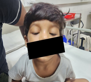 Ptosis seen prior to administering neostigmine.