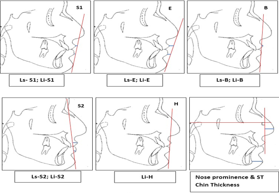 Linear parameters