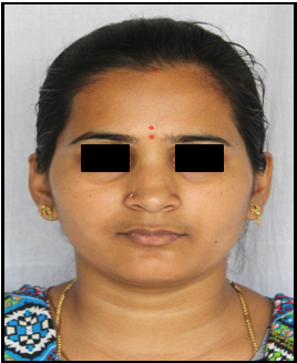Ideal proportions of face
