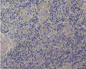 Histopathology slide