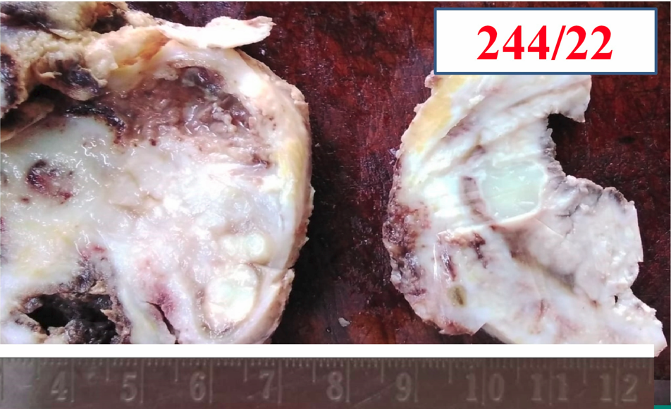 Gross appearance showing cystic spaces, tan white areas and hemorrhage
