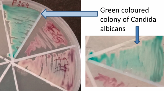 Chrome agar plate culture