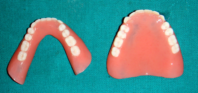 Complete dentures – occlusal surface
