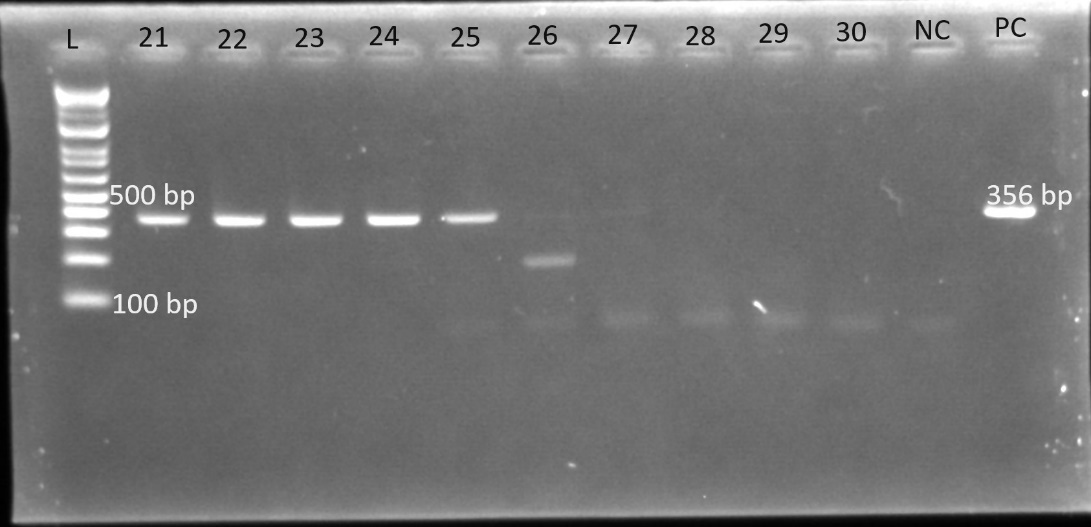 Electrophoresis gel for blaSHV(356bp) L is the ladder, Lane 21 to 30 are the isolates, followed by NC: a negative control and PC: a positive control.