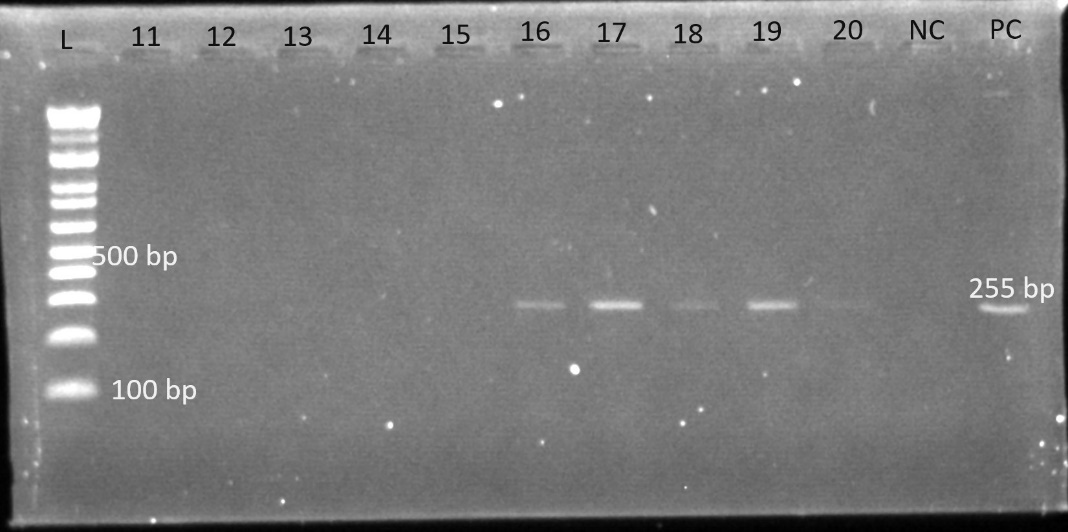 Electrophoresis gel for blaCTX-M(255bp) L is the ladder, Lane 11 to 20 are the isolates, followed by NC: negative control and PC: positive control.