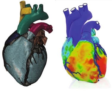 A digital twin of the heart
