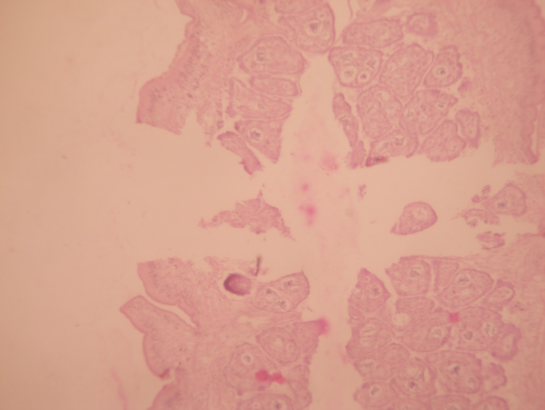 Clear vacuoles (washed lipid) in releasing eggs from gravid portion. (H&E stain x 10X)