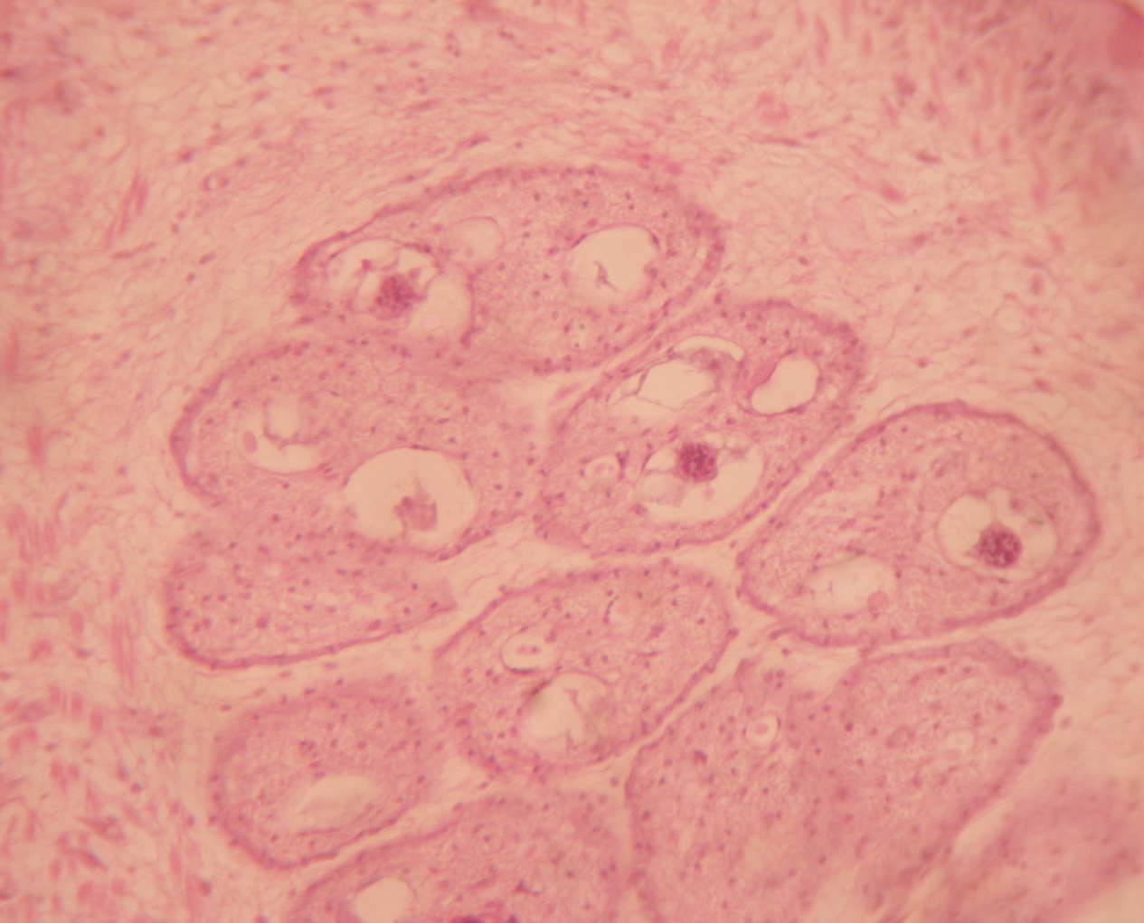 Clear vacuoles (washed lipid) in releasing eggs from gravid portion. (H&E stain x 40X)