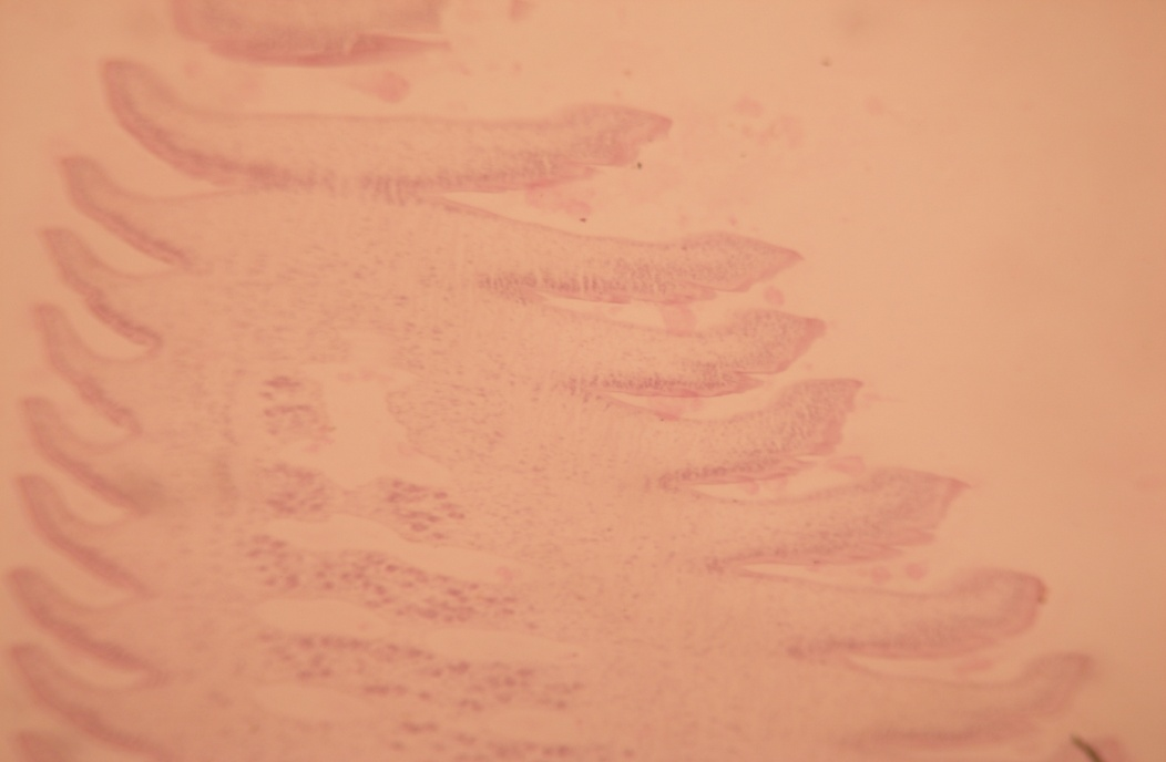 Presence of less glycogen in immature segment. (Mc Manus stain x10X)