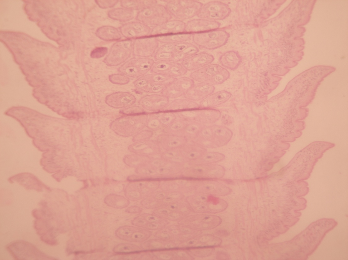 Presence of glycogen at periphery in mature segment. (Mc Manus stain x 10X)