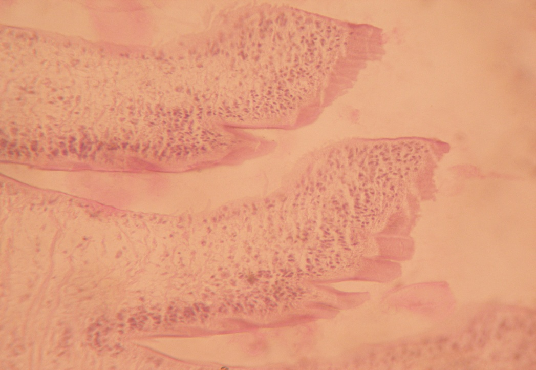 Presence of less glycogen in gravid segment. (Mc Manus stain x10X)