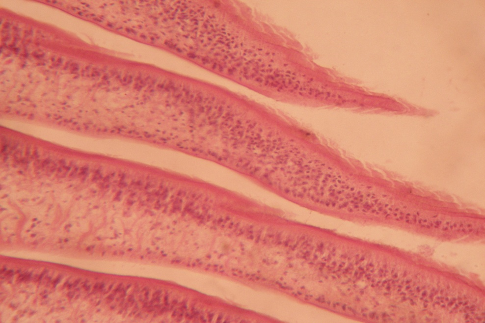 Presence of protein in immature segment. (Congo red stain x 10X)