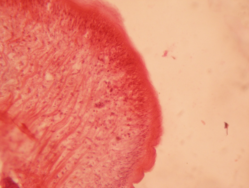 Presence of protein in mature segment.(Congo red stain x 10X)