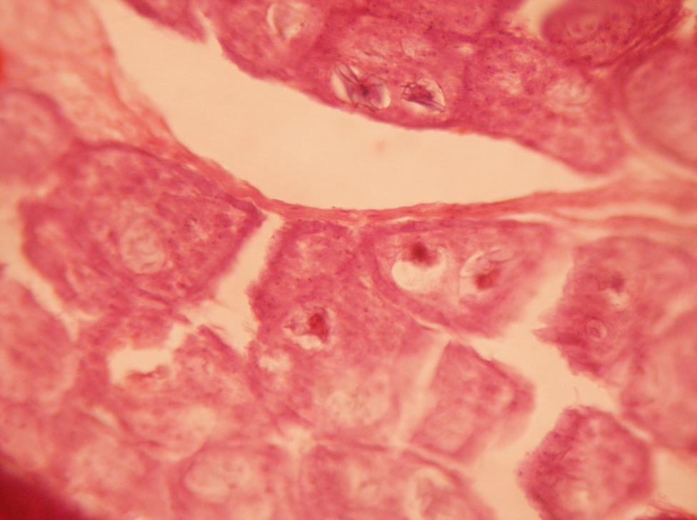 Presence of protein in gravid segment. (Congo red stain x 40X)