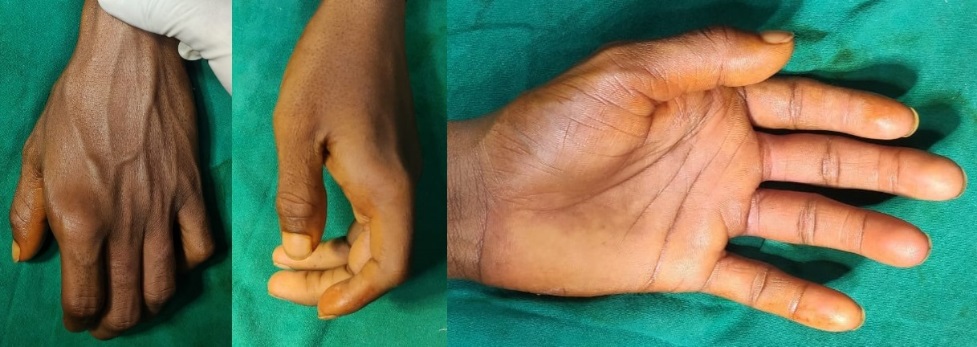 Pre operative clinical picture
