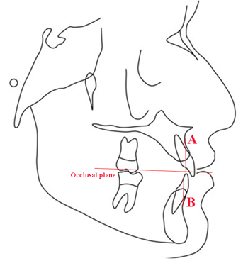 Schematic representation of measurement of wits appraisal