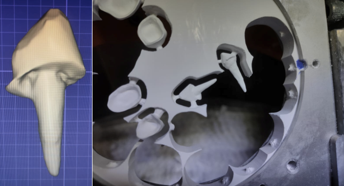 CAD-CAM (Designing and Milling) of Zirconia post n core