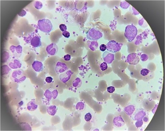 Cytochrome stain CML(oil immersion)