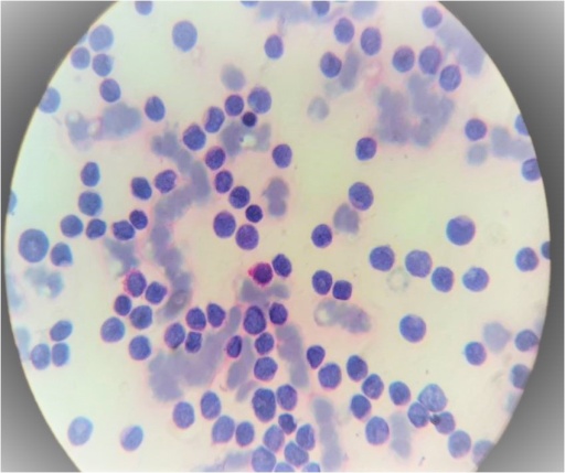 PAS stain(oil immersion): ALL