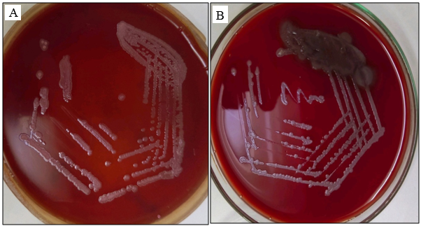 A: MacConkey agar rough non lactose fermenting colonies; B: Blood agar showing rough greyish colonies. 