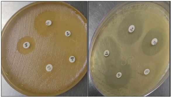 Antimicrobial susceptibility testing  