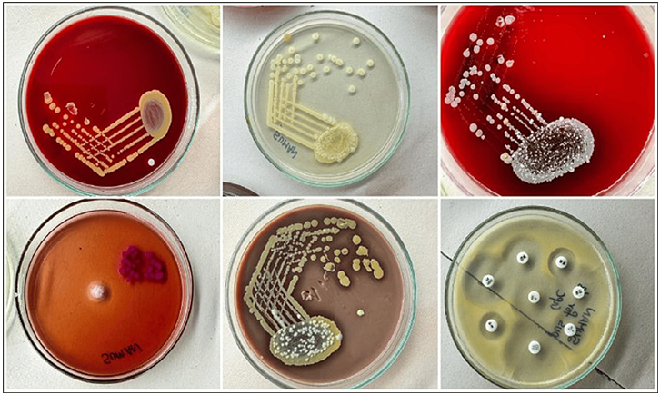 Staphylococcal aureus isolated from different bacterial cultural medias and image showing antibiotic sensitivity testing