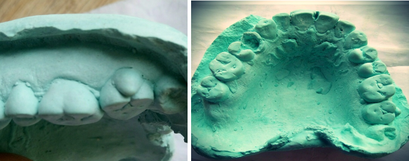 Showing parastyle on dental cast (buccal & occlusal view)