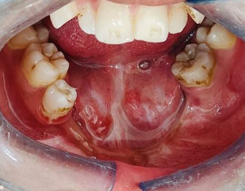 Intraoral view