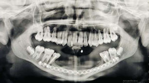 Panoramic radiograph