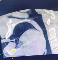 CBCT-sagittal view