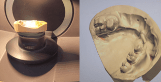 3 shape E1 lab scanning