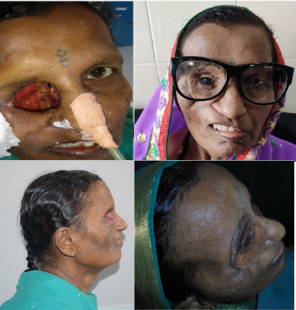 Pre-treatment and Post treatment Views