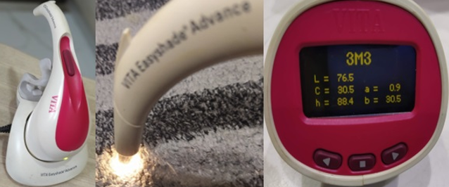 Spectrophototmeter (Vita Easyshade)