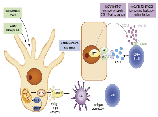 Mediators in vitiligo