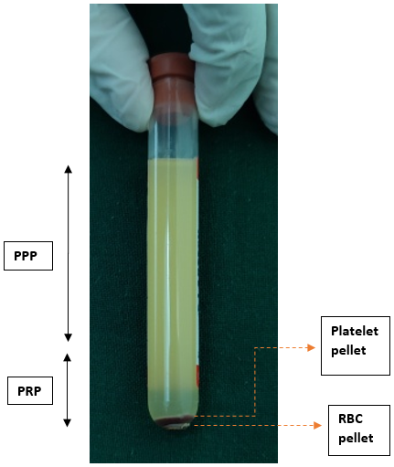 After 2nd spin, upper 3/4th PPP is formed and lower 1/4th PRP is formed