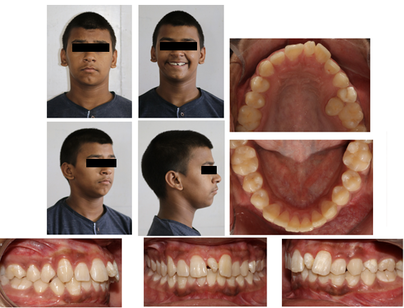 Pre treatment photographs