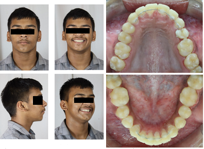 Post treatment photographs