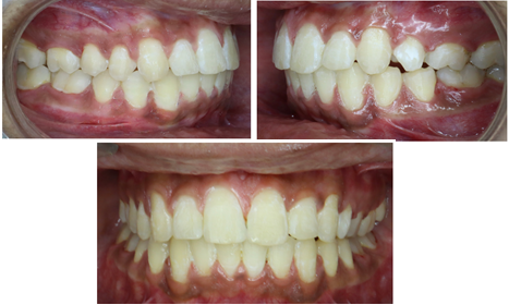 Post treatment photographs