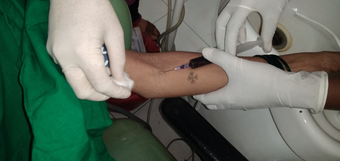 Autologous blood drawn from cubital fossa