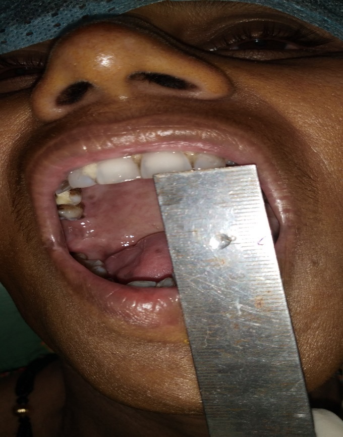 Post op clinical photograph 