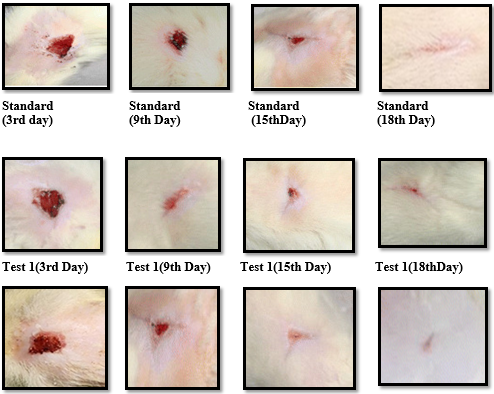 Effect of herbal formulation on healing of excision wound model