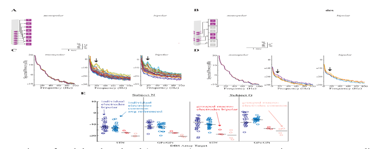 Comparison of peak low beta band (12–20 Hz) power amongst resting state LFP recording montages. Examplemonopolar and bipolar row subtraction recordings (A) and power spectra (C) from one column of DBS array electrodes in Subject N in the naïve condition