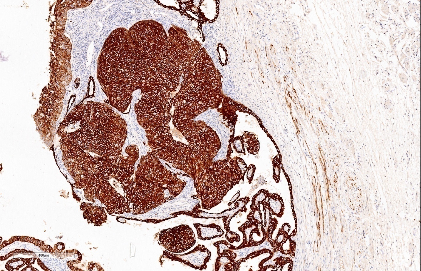 Diffuse and strong positivity of CK