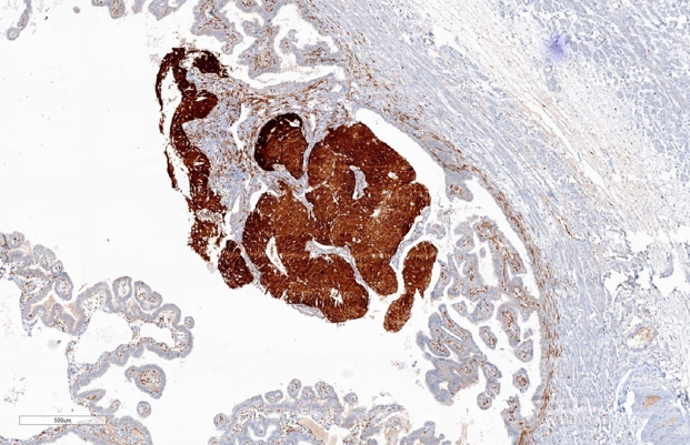 Diffuse and strong positivity of P-16